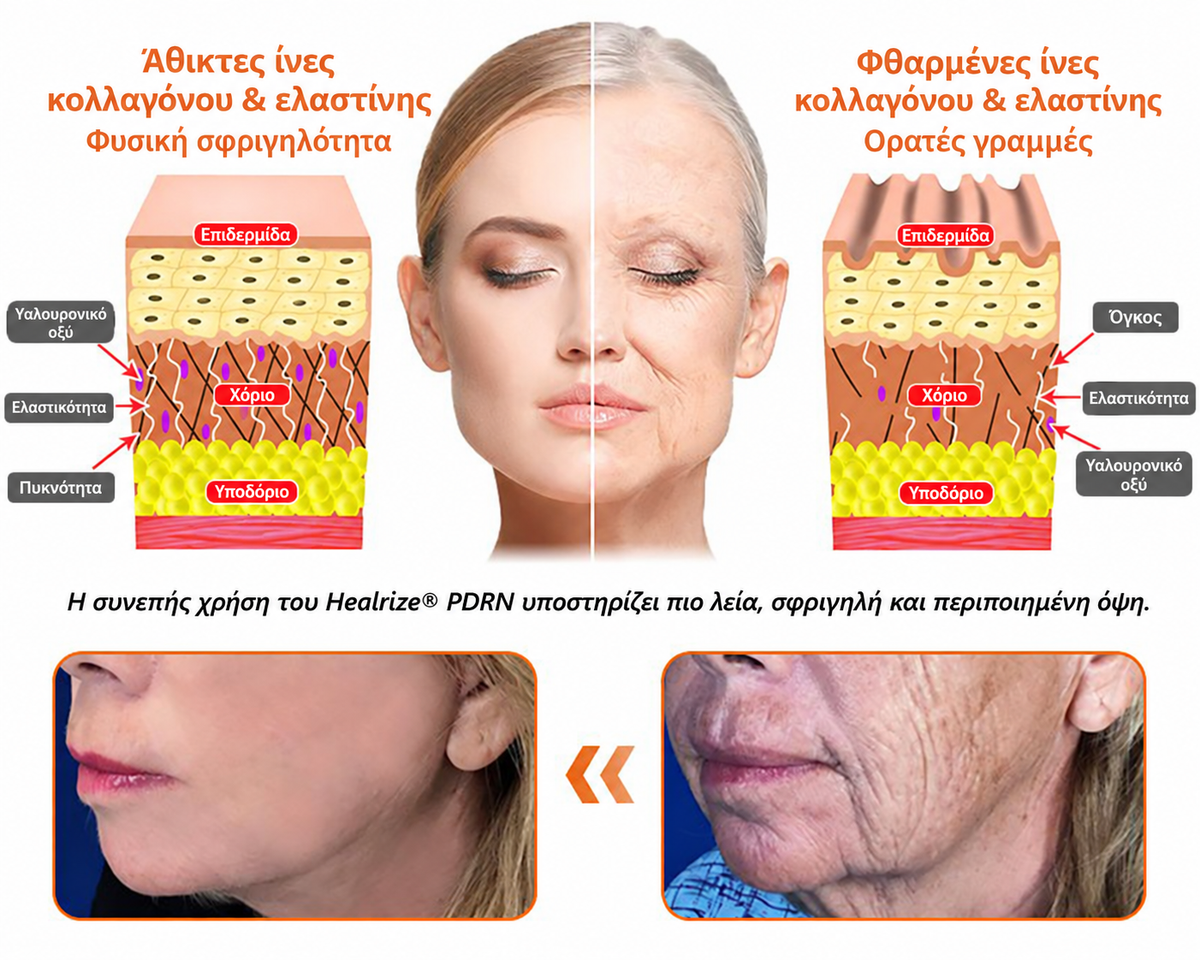 Healrize PDRN — Διάγραμμα επιδερμίδας