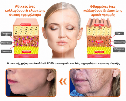 Healrize PDRN — Διάγραμμα επιδερμίδας