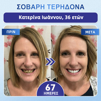 GarageLine® 🦷 Στοματικές Ταινίες Ταχείας Διάλυσης Tideglusib για την Επιδιόρθωση Δοντιών & Ούλων ✨ (Υποστηρίζει την επιδιόρθωση των δοντιών και βοηθά στην ανακούφιση από την ενόχληση των ούλων και άλλα κοινά στοματικά προβλήματα) 👑💍
