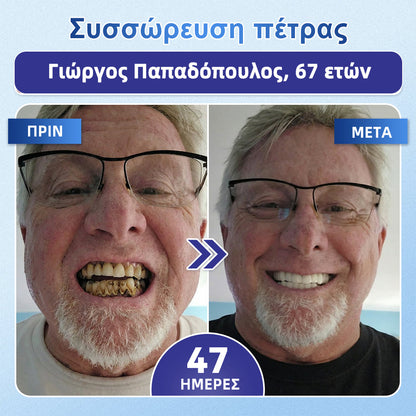 GarageLine® 🦷 Στοματικές Ταινίες Ταχείας Διάλυσης Tideglusib για την Επιδιόρθωση Δοντιών & Ούλων ✨ (Υποστηρίζει την επιδιόρθωση των δοντιών και βοηθά στην ανακούφιση από την ενόχληση των ούλων και άλλα κοινά στοματικά προβλήματα) 👑💍