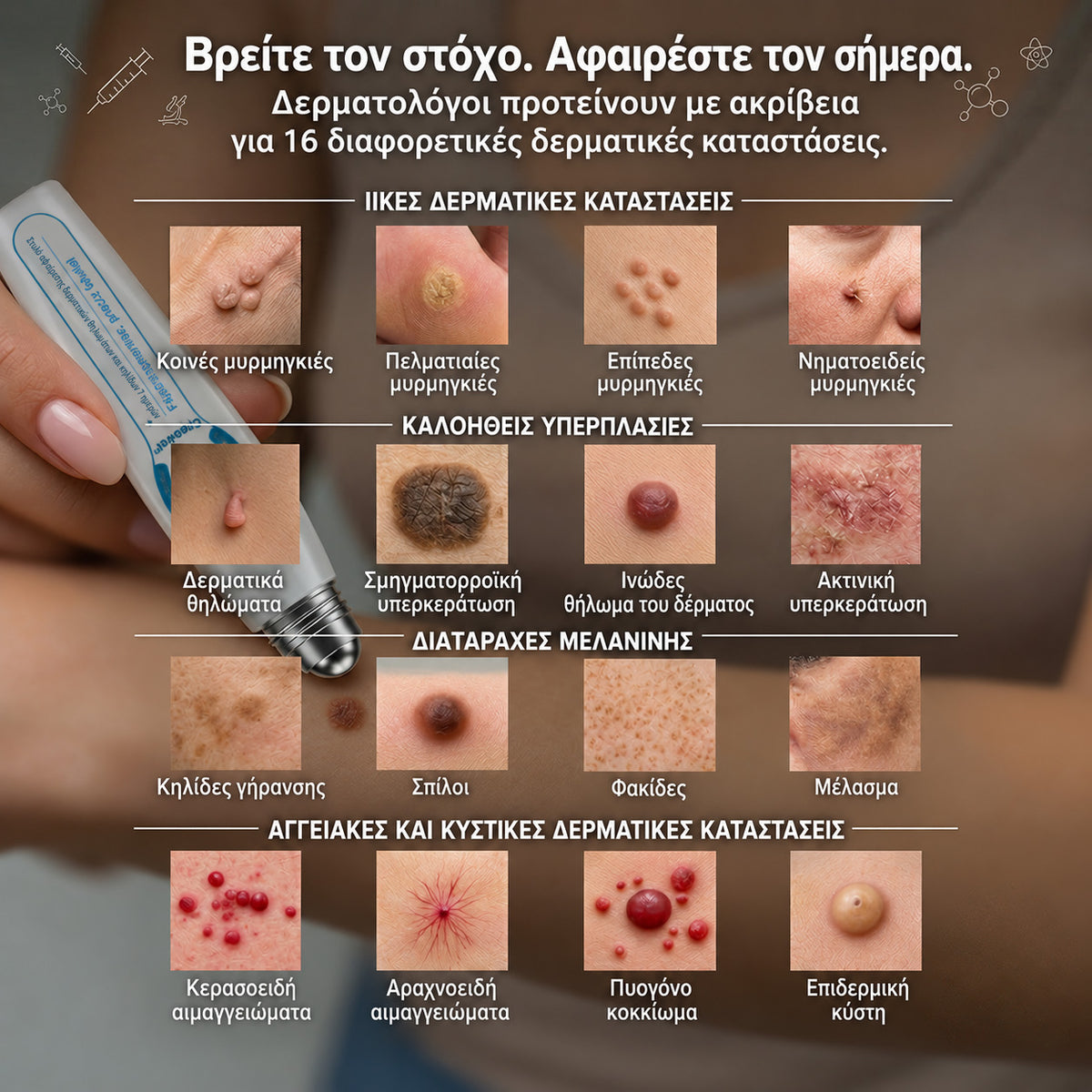 🥥 Επίσημο κατάστημα Creawel® Διορθωτικό Roll-On 7 Ημερών για Θηλώματα & Κηλίδες (ανώδυνο, χωρίς σημάδια)🖋️🌕2️⃣7️⃣