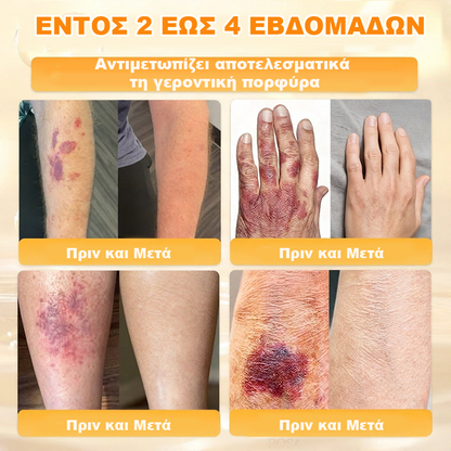 👩‍⚕️Συνιστάται από το Νοσοκομείο Semmelweis · Επίσημο κατάστημα BENU✨ Hudros® Κρέμα Ανανέωσης Δέρματος με Δηλητήριο Μέλισσας