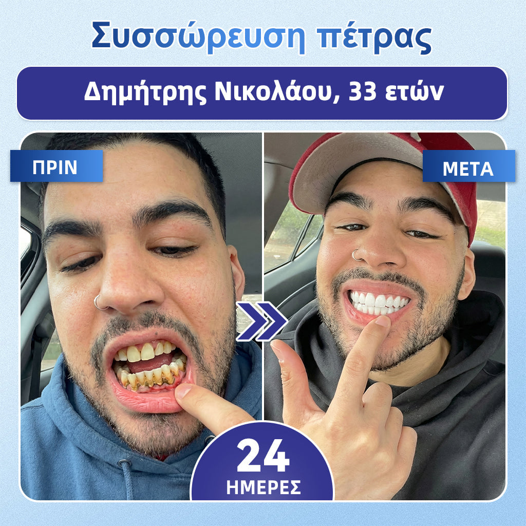 GarageLine® 🦷 Στοματικές Ταινίες Ταχείας Διάλυσης Tideglusib για την Επιδιόρθωση Δοντιών & Ούλων ✨ (Υποστηρίζει την επιδιόρθωση των δοντιών και βοηθά στην ανακούφιση από την ενόχληση των ούλων και άλλα κοινά στοματικά προβλήματα) 👑💍