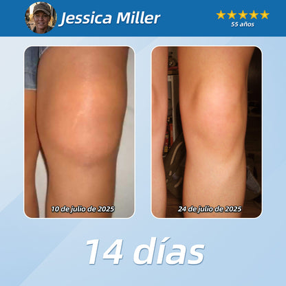 𝐋𝐨𝐜𝐢ó𝐧 𝐫𝐞𝐩𝐚𝐫𝐚𝐝𝐨𝐫𝐚 𝐜𝐚𝐥𝐦𝐚𝐧𝐭𝐞 𝐂𝐮𝐫𝐞𝐕𝐢𝐯𝐨® 👩‍⚕️ 𝐀𝐥𝐢𝐯𝐢𝐚 𝐞𝐥 𝐝𝐨𝐥𝐨𝐫 𝐦𝐮𝐬𝐜𝐮𝐥𝐚𝐫, 𝐚𝐫𝐭𝐢𝐜𝐮𝐥𝐚𝐫 𝐲 𝐧𝐞𝐫𝐯𝐢𝐨𝐬𝐨 🌞（西班牙)