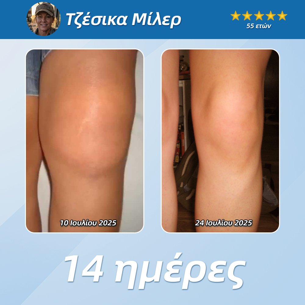 CureVivo® Ανακουφιστική & Επανορθωτική Λοσιόν 👩‍⚕️ Για Πόνους Μυών, Αρθρώσεων & Νεύρων🌞