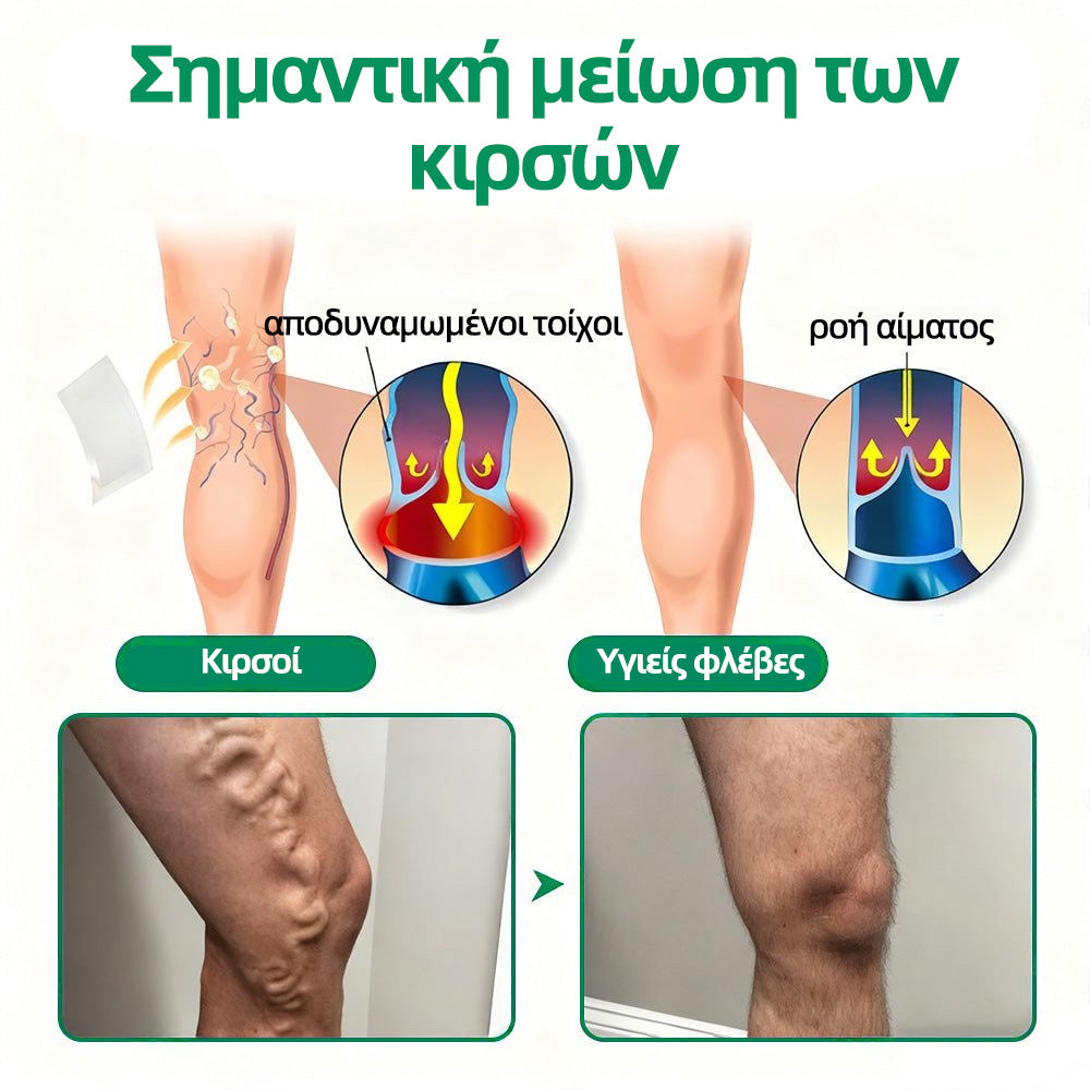 🇬🇷👨‍⚕️✅ Healrize® VeinTarget Μικροβελονιστικό Επίθεμα⚡Άμεση Ανακούφιση, Μακροχρόνια Αποτελέσματα🥝