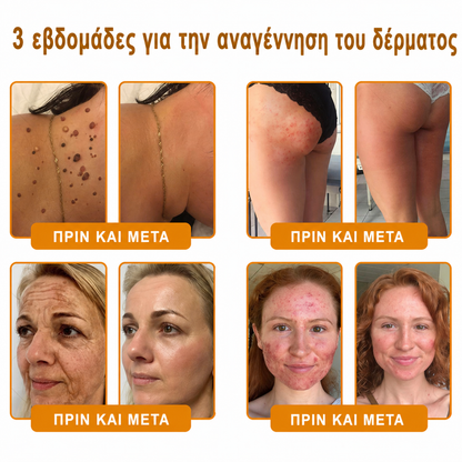 👩‍⚕️Συνιστάται από το Νοσοκομείο Semmelweis · Επίσημο κατάστημα BENU✨ Hudros® Κρέμα Ανανέωσης Δέρματος με Δηλητήριο Μέλισσας