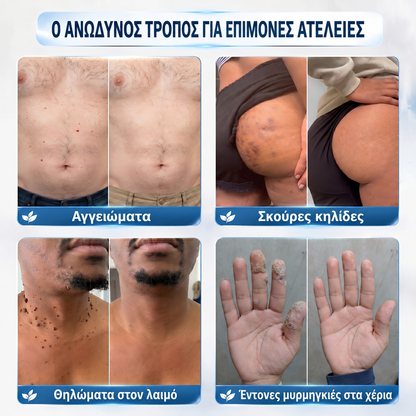 Nekiss για διαφορετικούς τύπους ατελειών